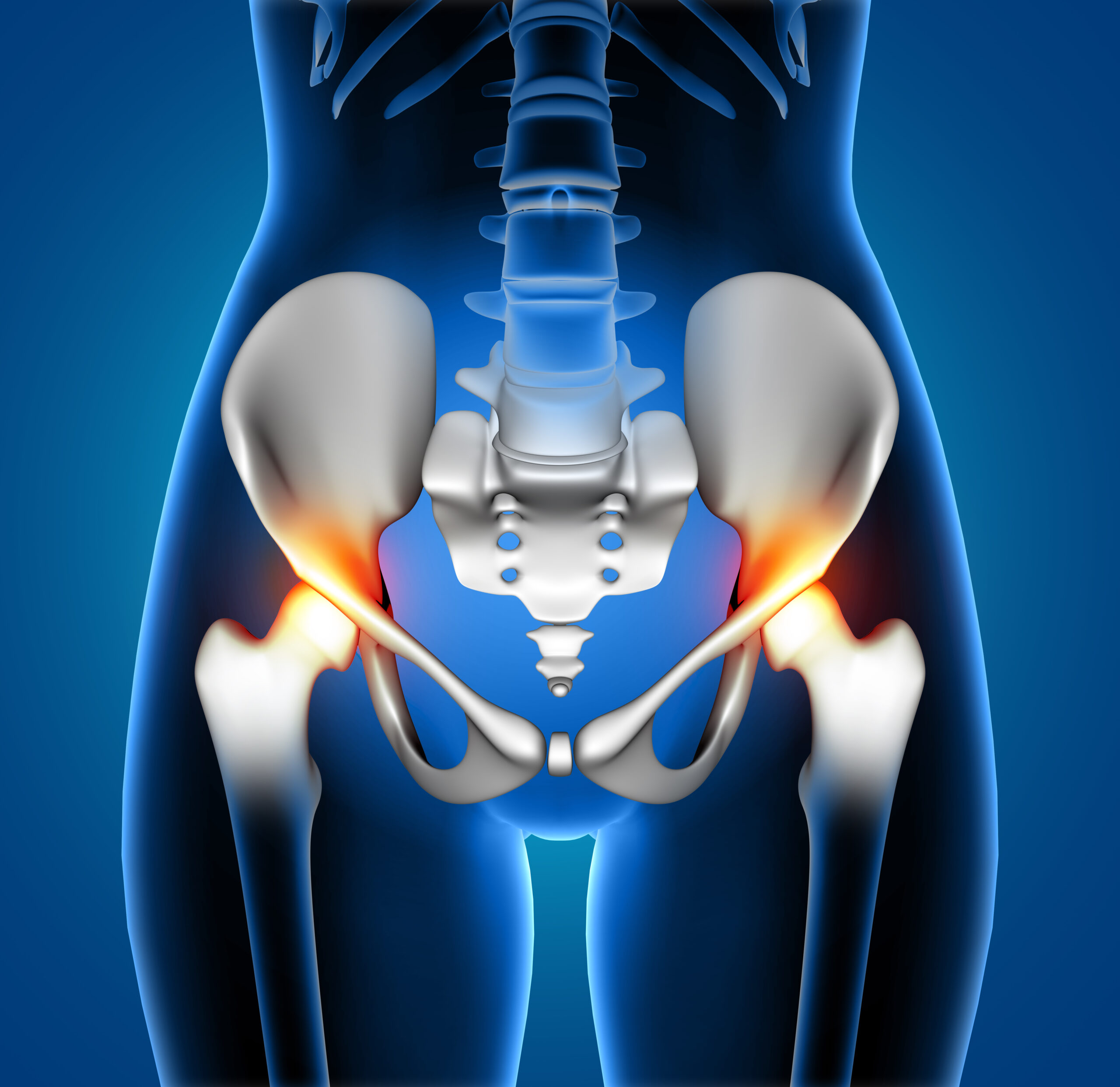 Total Hip Replacement – Comprehensive Guide to Surgery, Causes, and Recovery